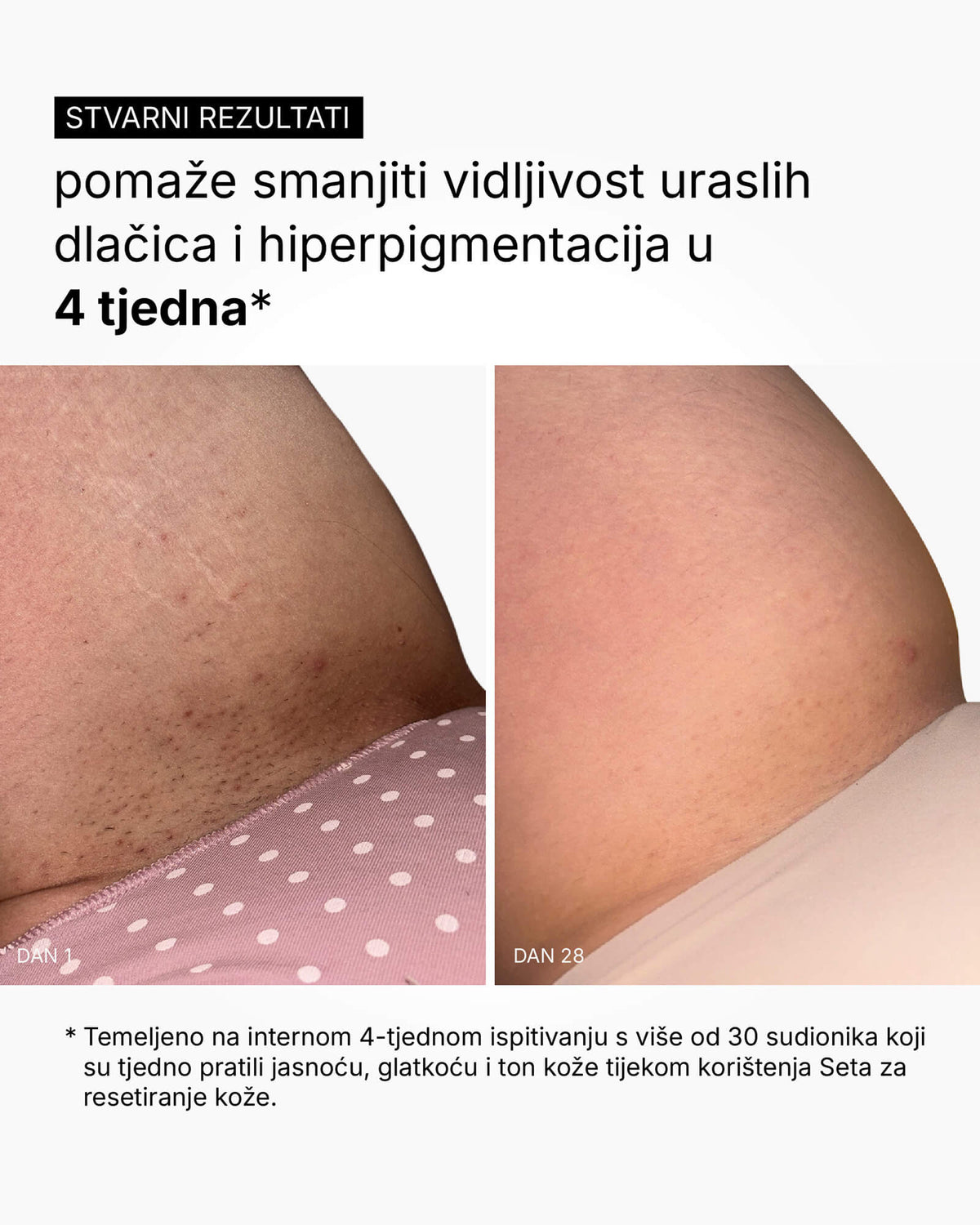 Skin Reset Set - Nega za celotno telo