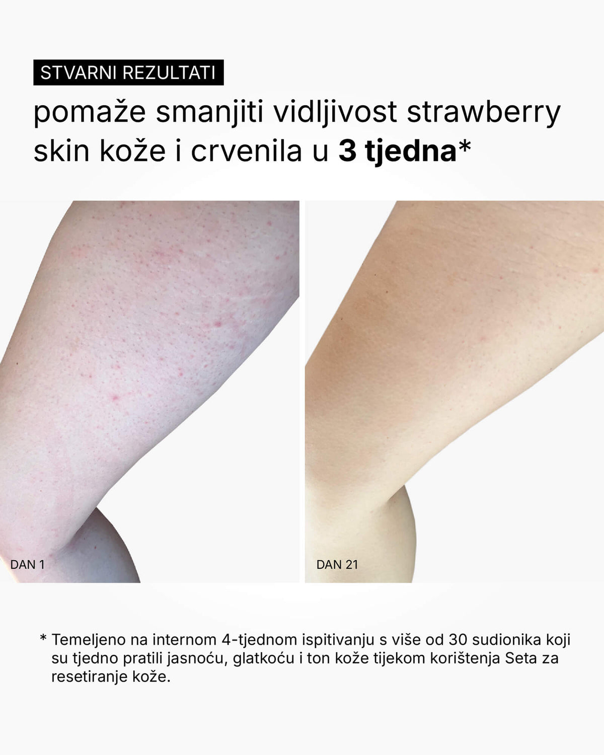 Skin Reset Set - Nega za celotno telo